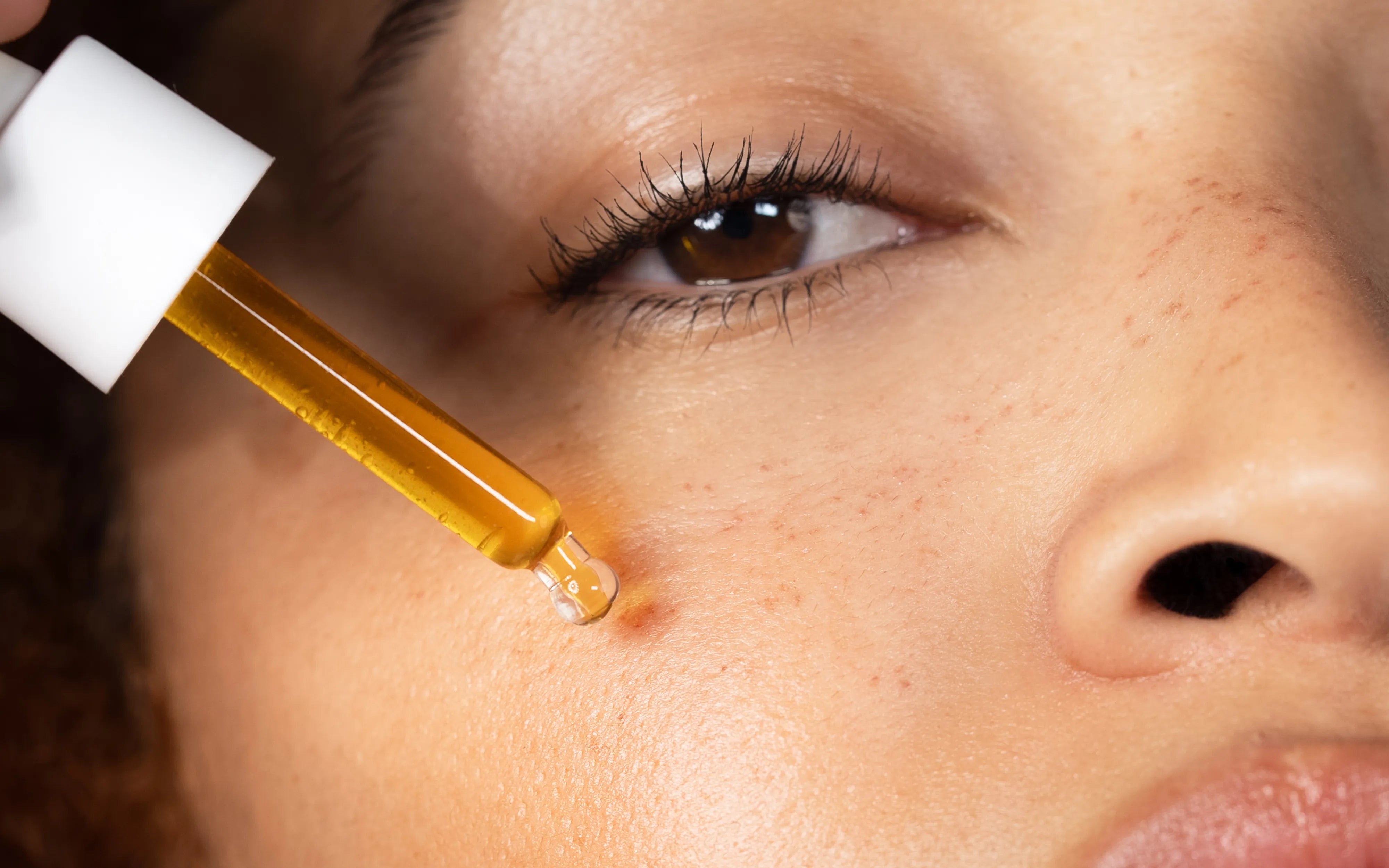 Irritation & Redness – Seasonly