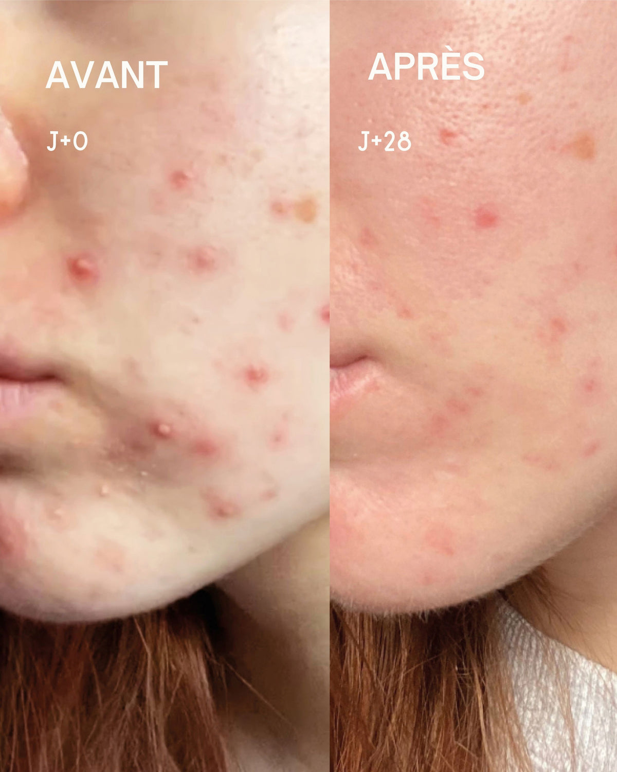 Duo Taches &amp; Imperfections