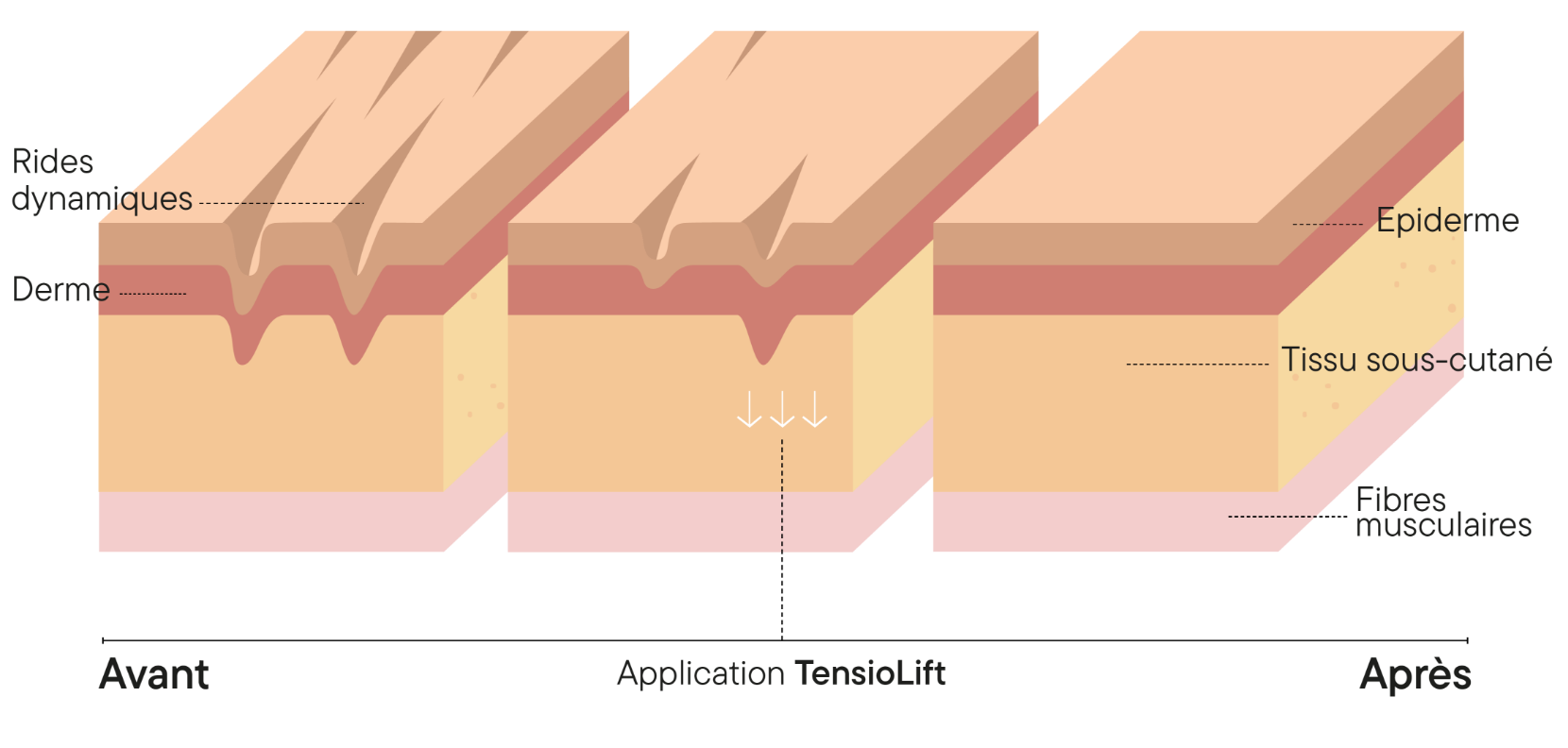 schema de l'épiderme isométrie