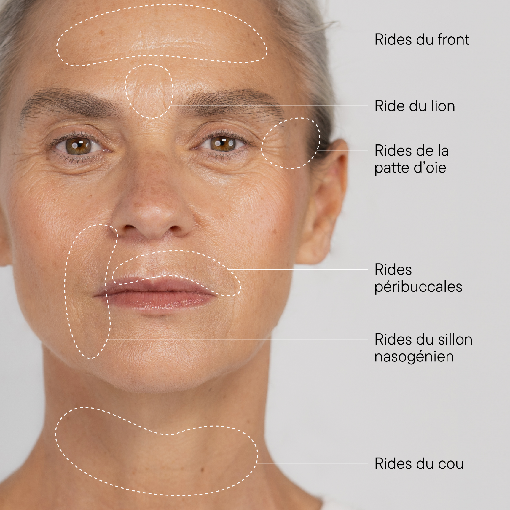 Schema des rides du visage