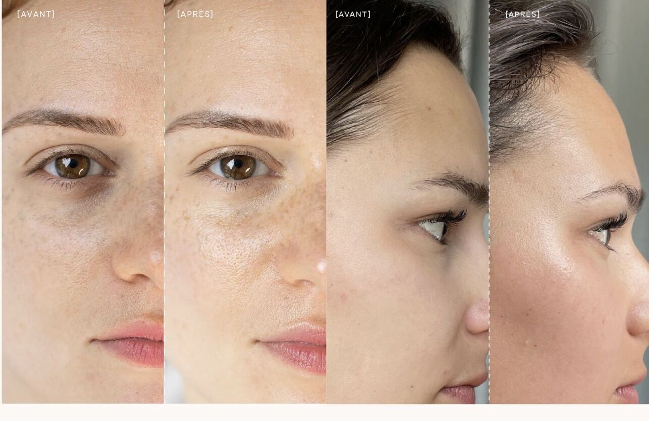 Avant / Après — résultats Bride & Glow